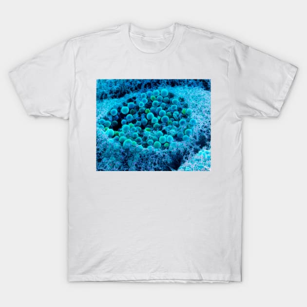 Col. SEM of eye melanocyte cell & pigment granules (P424/0108) T-Shirt by SciencePhoto